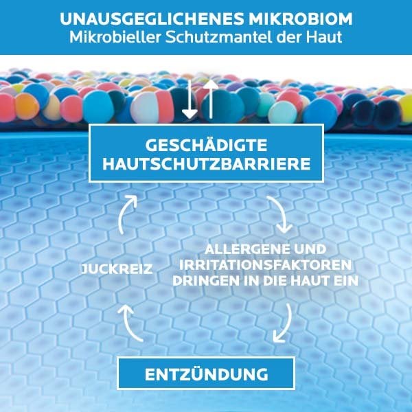 Grafik mit dem Titel 'Unausgeglichenes Mikrobiom - Mikrobieller Schutzmantel der Haut'. Dargestellt ist ein Kreislauf der durch ein unausgeglichenes Mikrobiom der Haut gefördert wird: Durch eine beschädigte Hautschutzbarriere dringen Allergene und Irritationsfaktoren in die Haut ein. Dies führt zu Entzündunen und Juckreiz, die wiederrum eine geschädigte Hautschutzbarriere fördern.